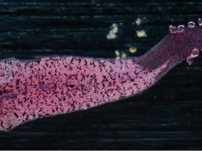 What’s Sucking the Life Out of You? It Might be&nbsp;Parasites